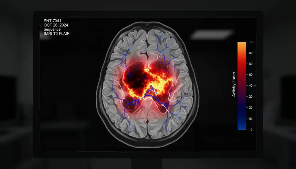 MRI scan displaying brain activity with vibrant colors. Part of Sumer Datta’s journey from garage innovation to a global breakthrough in neuroscience.